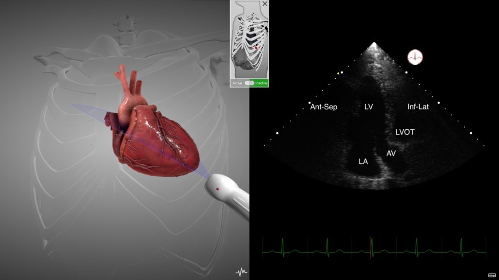 Echocardiography Simulator Intelligent Ultrasound