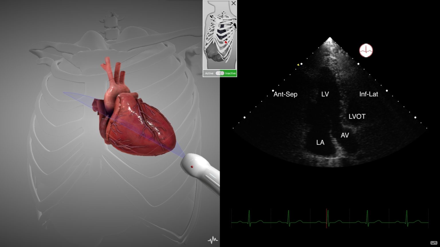 Echocardiography Simulator Intelligent Ultrasound