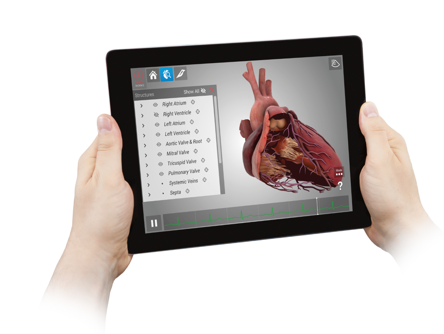 Heartworks - Intelligent Ultrasound