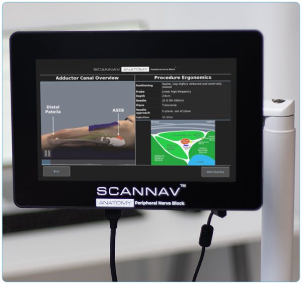 Scannav Anatomy Peripheral Nerve Block Pnb Intelligent Ultrasound