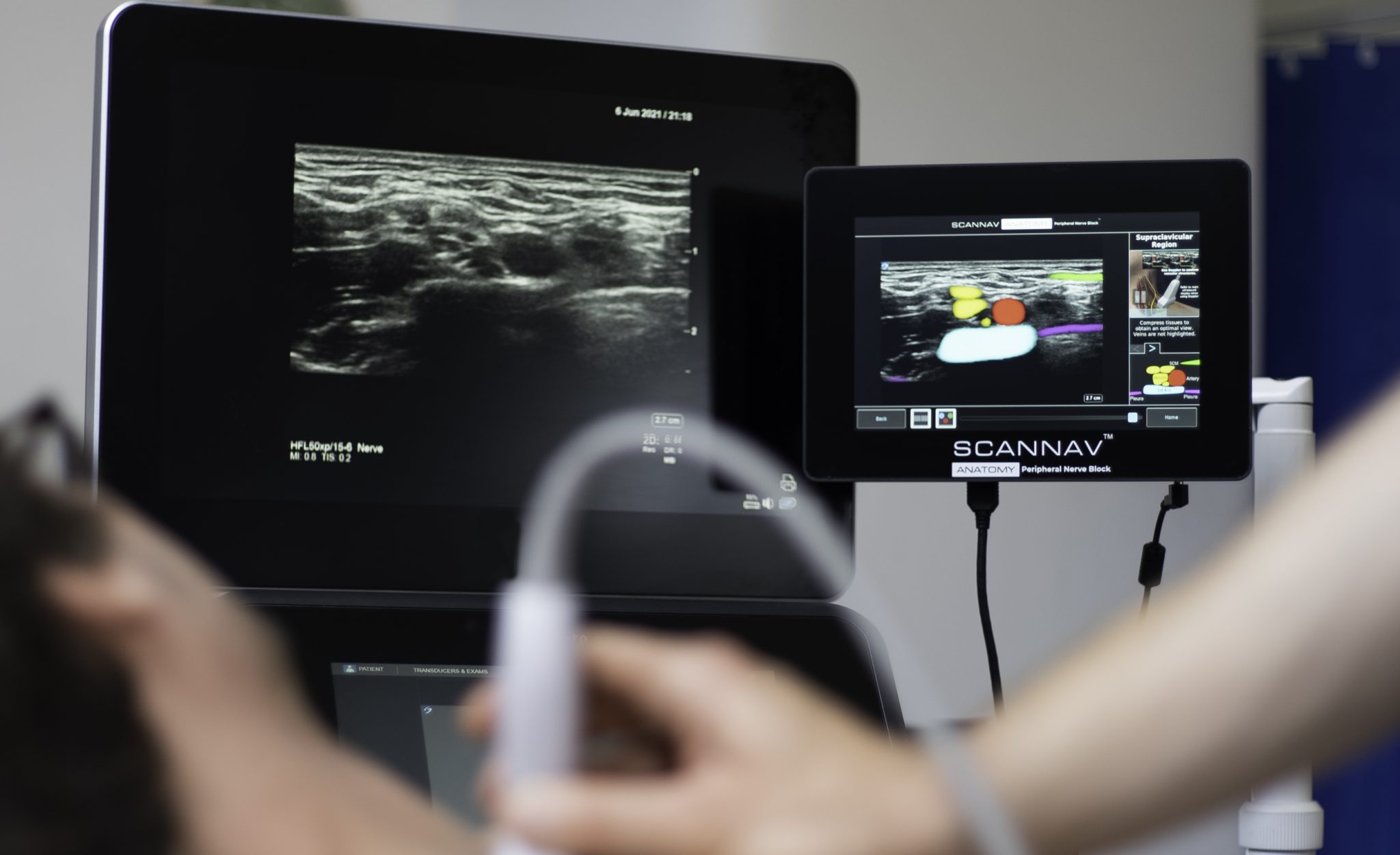 Scannav Anatomy Peripheral Nerve Block Pnb Intelligent Ultrasound