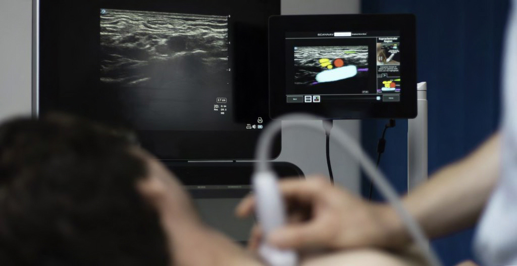 Scannav Anatomy Peripheral Nerve Block Pnb Intelligent Ultrasound