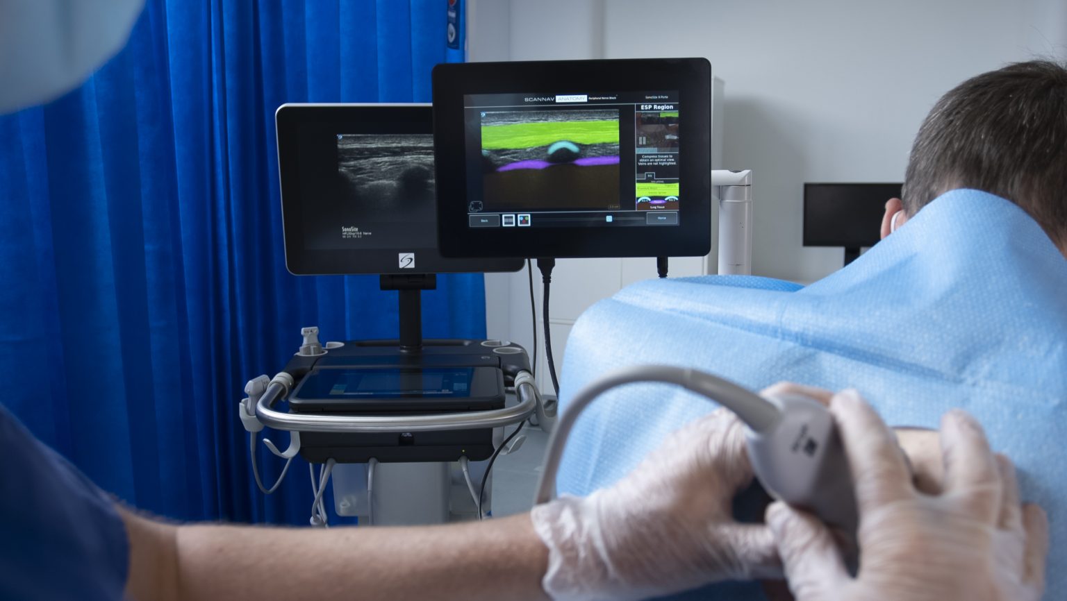 Intelligent Ultrasound’s Scannav™ Anatomy Peripheral Nerve Block Shown To Increase The Delivery