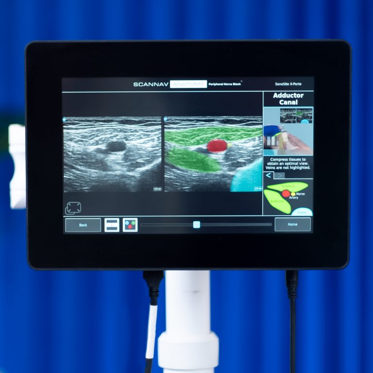 Scannav Anatomy Peripheral Nerve Block Pnb Intelligent Ultrasound 7887