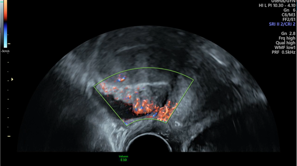 ScanTrainer Endo Screengrab